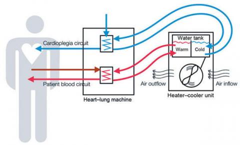 Sorin 3T heater coller system