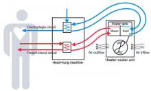 Sorin 3T heater coller system